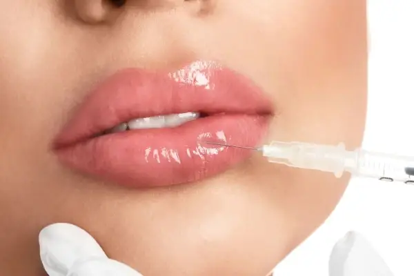 Aumento de labios con acido hialuronico